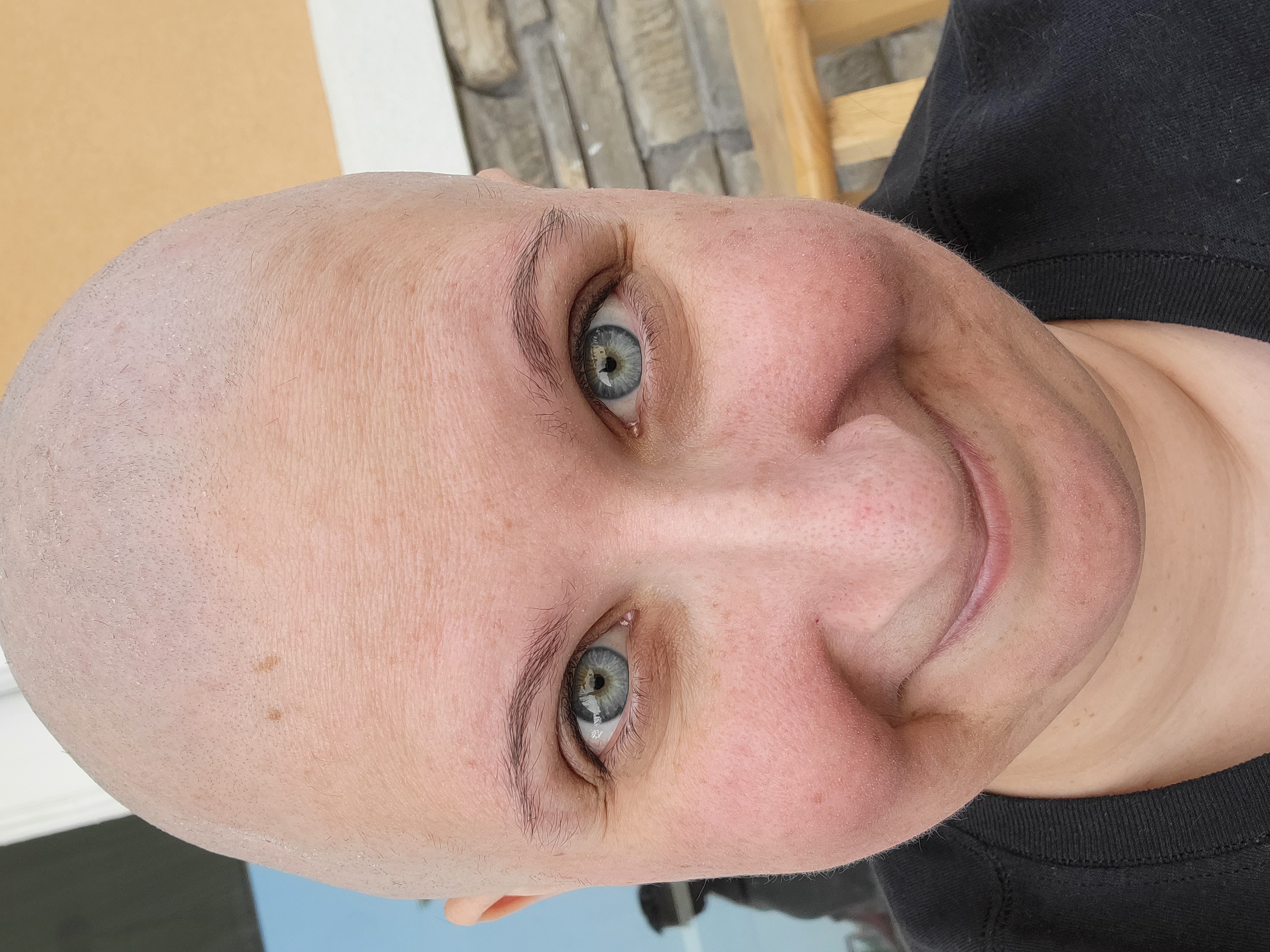 A close up picture of a bald woman who has just shaved her head.