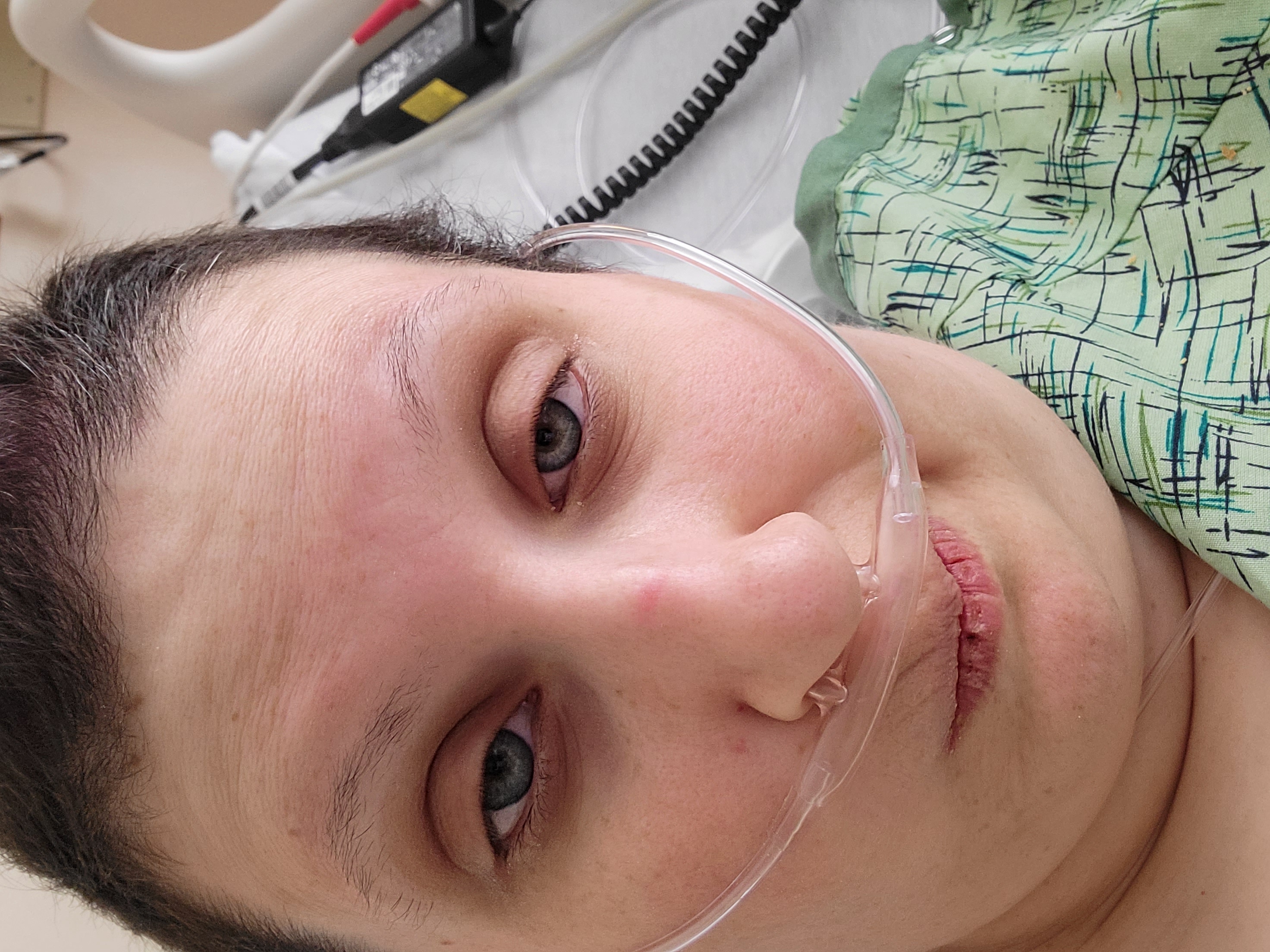 A close up picture of a woman with short brown hair, with an oxygen mask in a hospital bed after having had a full hysterectomy.