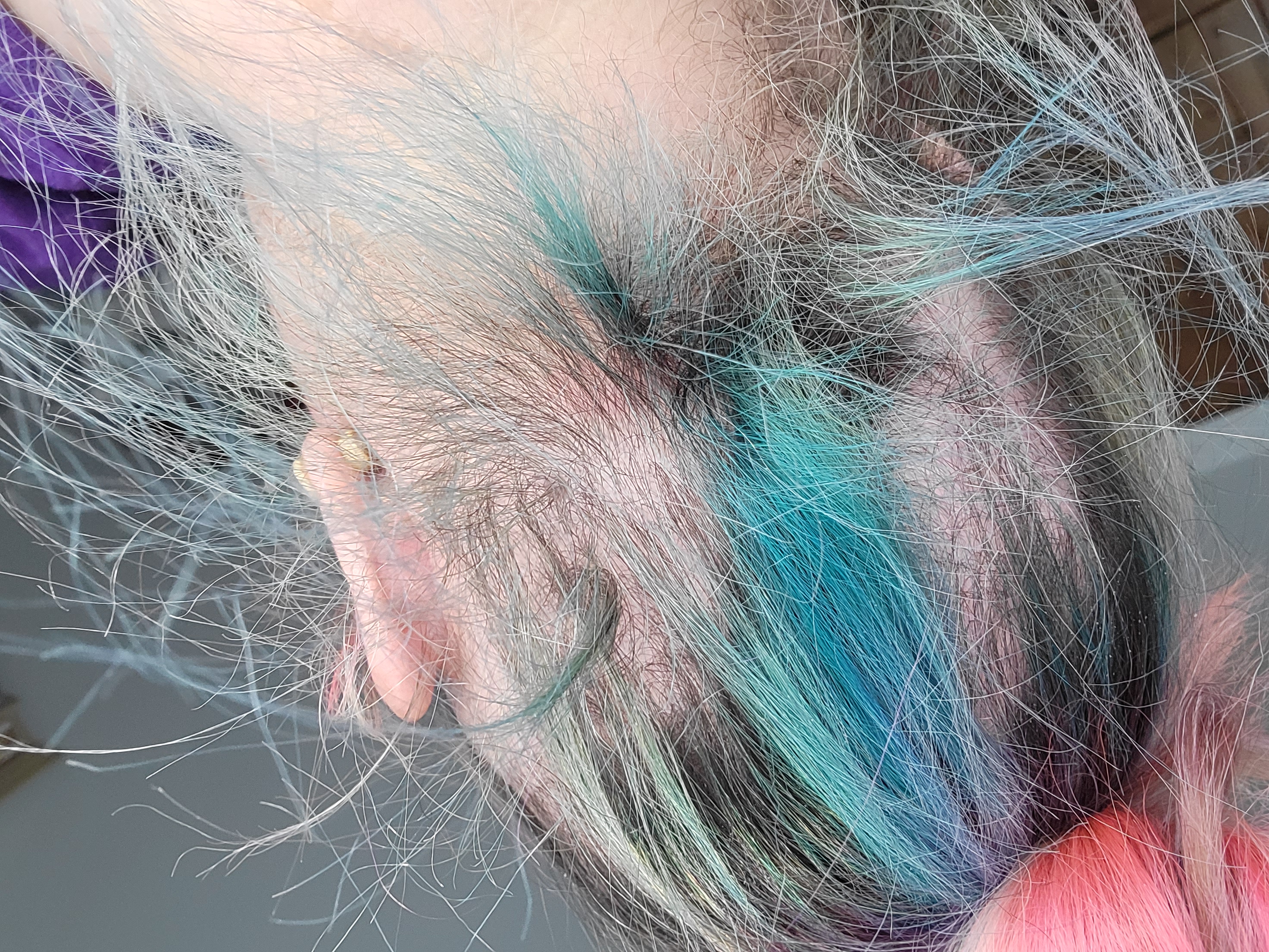 The back of a womans head, showing the patches where her hair has started falling out from chemotherapy.