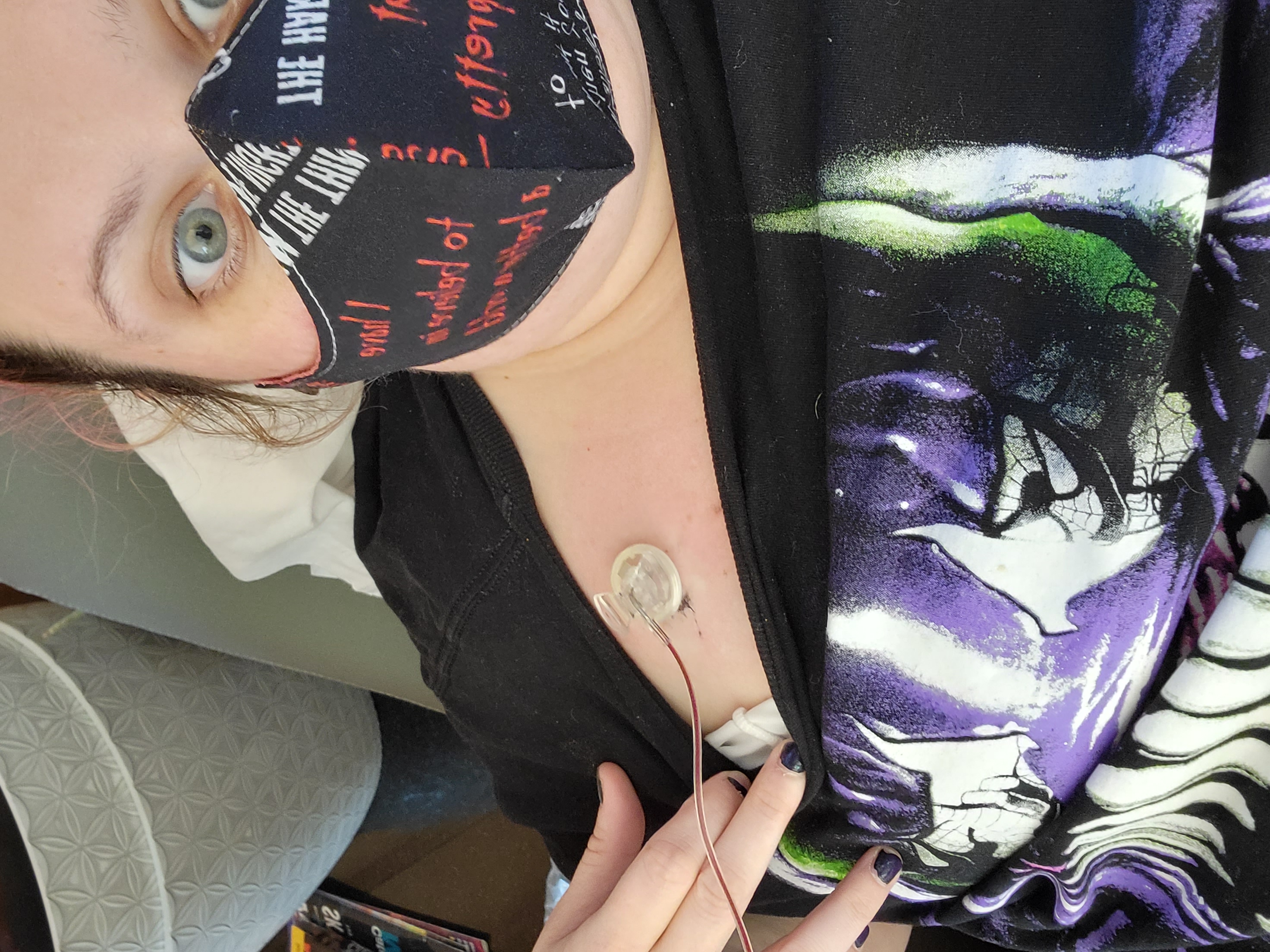 A cancer patient wearing a mask and a blakc and purple shirt, pulling her shirt down just enough to show off her accessed port.