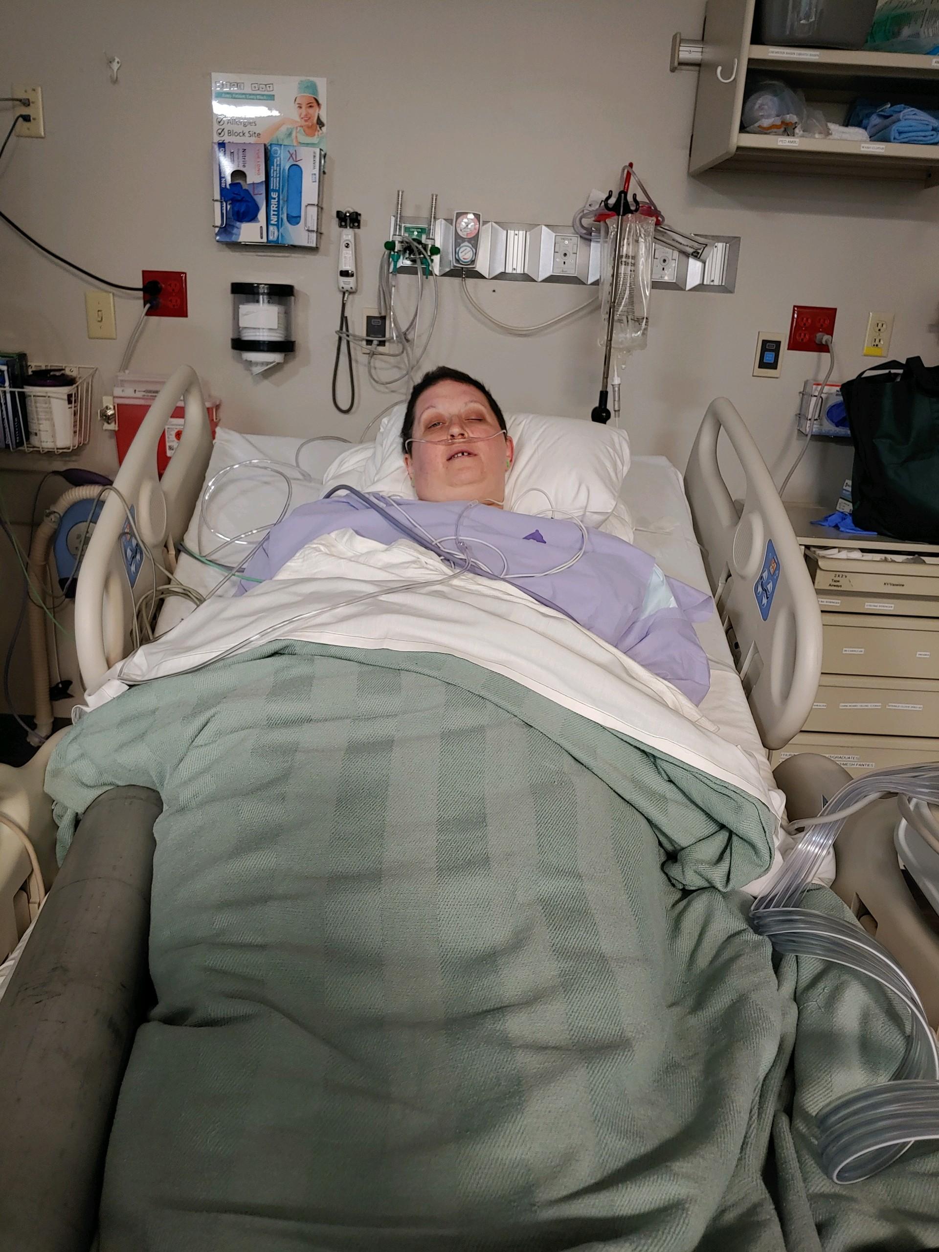A woman with short brown hair laying in a hospital bed sleeping after surgery.